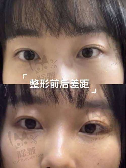 昆山容妍整形柴云医生擅长项目