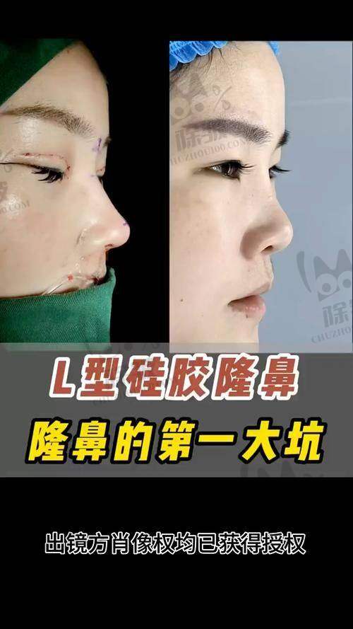 张晓棠医生坐诊医院