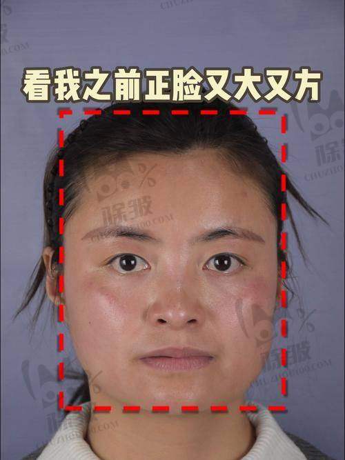 崔宇景医生坐诊医院