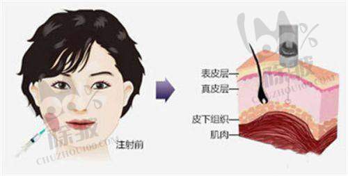 宁夏华美整形美容医院 - 何林医生、王宏伟医生