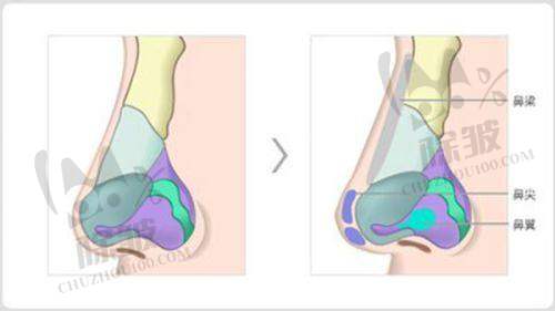 2. 价格透明度:影响除皱费用的关键因素