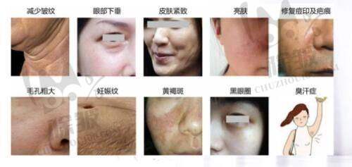 杭州联合丽格第六医疗美容医院乔雅登丰颜玻尿酸预约挂号