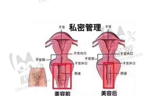 杭州联合丽格第六医疗美容医院乔雅登丰颜玻尿酸真人实例