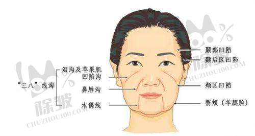 除皱项目