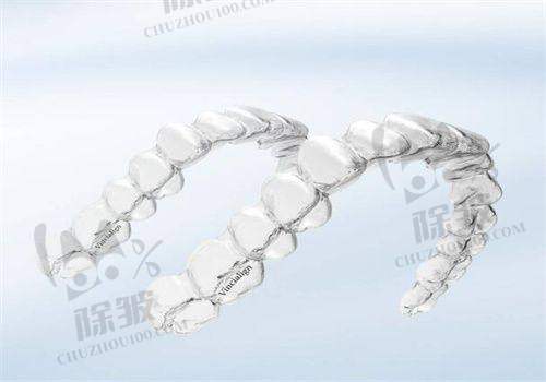 深圳中环口腔医院是正规医院吗?