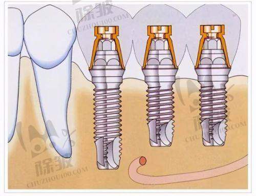 深圳中环口腔医院地址电话营业时间