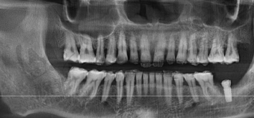 深圳中环口腔医院收费价格表/收费标准