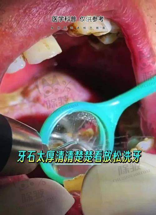 深圳中环口腔医院医生团队实力强大及骨干医生简介