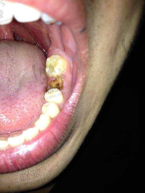 深圳中环口腔医院特色项目及技术优势