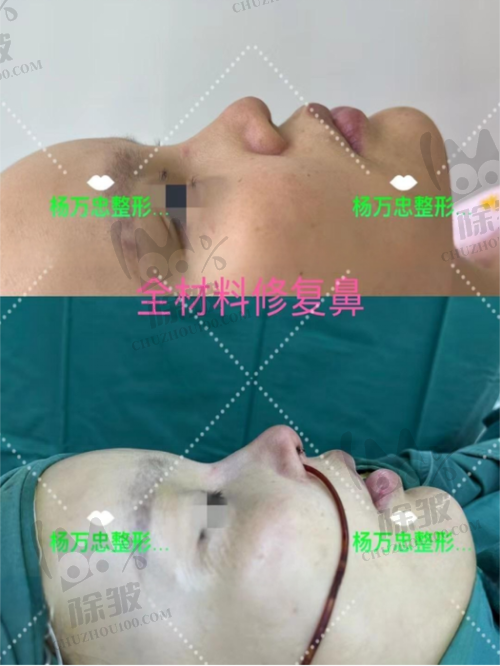 台州丽雅医疗美容医院真人口碑评价怎么样?