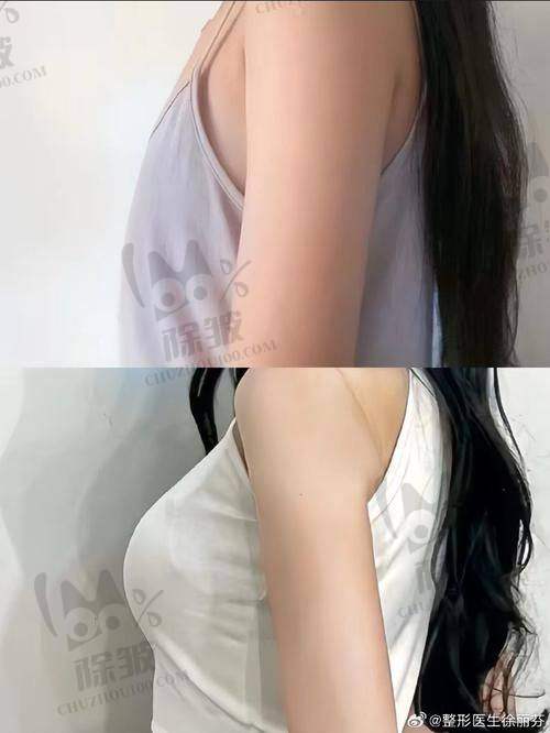 台州丽雅医疗美容医院收费价格表/收费标准