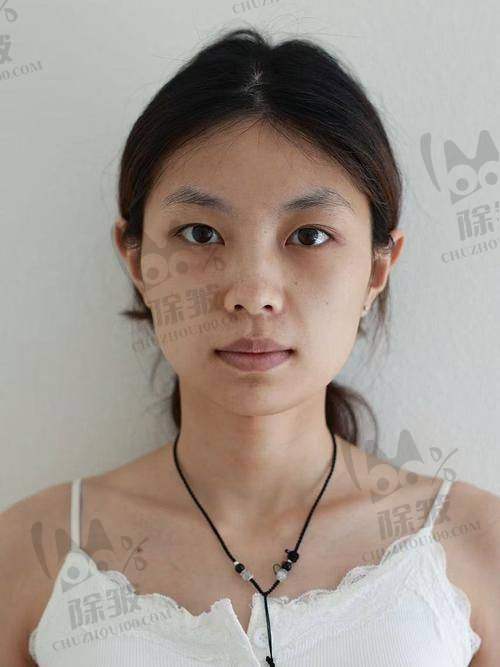 台州丽雅医疗美容医院是正规医院吗?