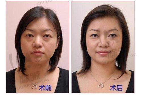 韩国美乐皮肤科的高端齐全仪器与显著成效