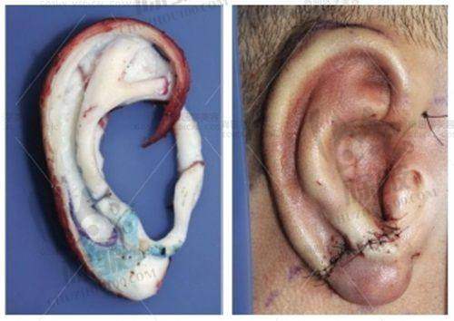 韩国美乐皮肤科的便捷预约方式与贴心服务